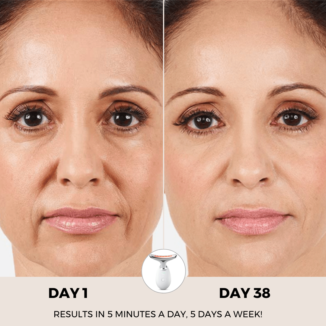 Paquete RevitaCare® Lift Pro