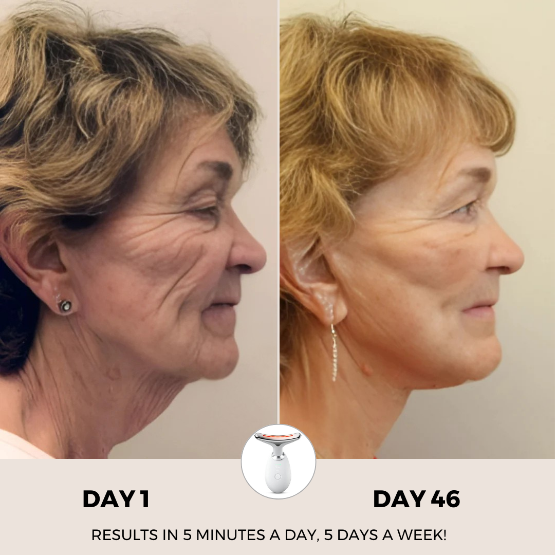 Paquete RevitaCare® Lift Pro