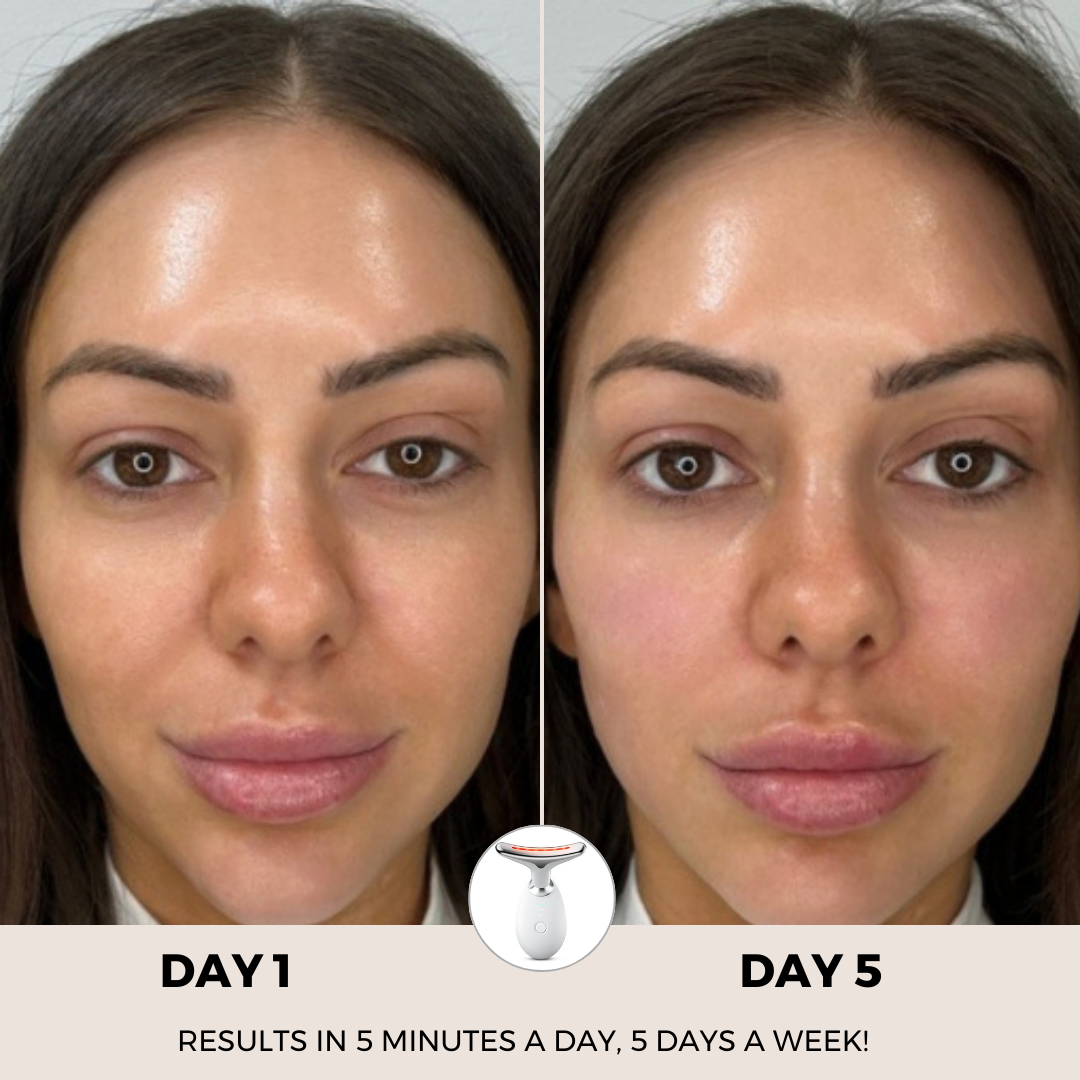 Paquete RevitaCare® Lift Pro