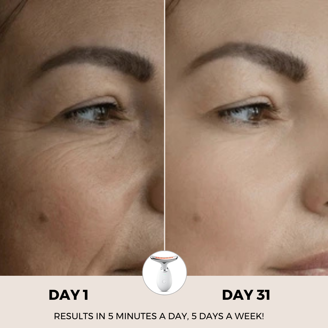 Paquete RevitaCare® Lift Pro
